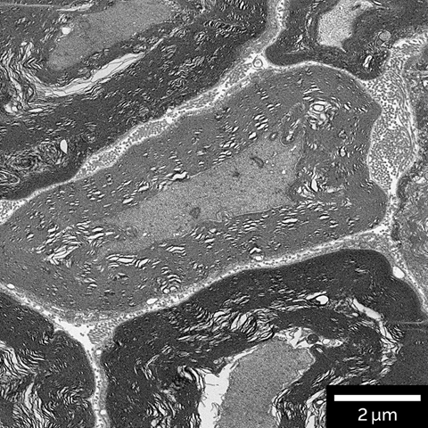 Brain tissue - 2nm