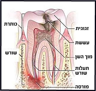 טיפולי שורש