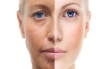 טיפולי מיזותרפיה