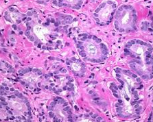 מתן חוות דעת שניה על אבחנות פתולוגיות חיצוניות